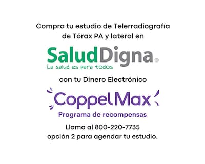 Foto 1 | Paquete de Estudio Salud Digna Telerradiografía de Tórax PA y Lateral