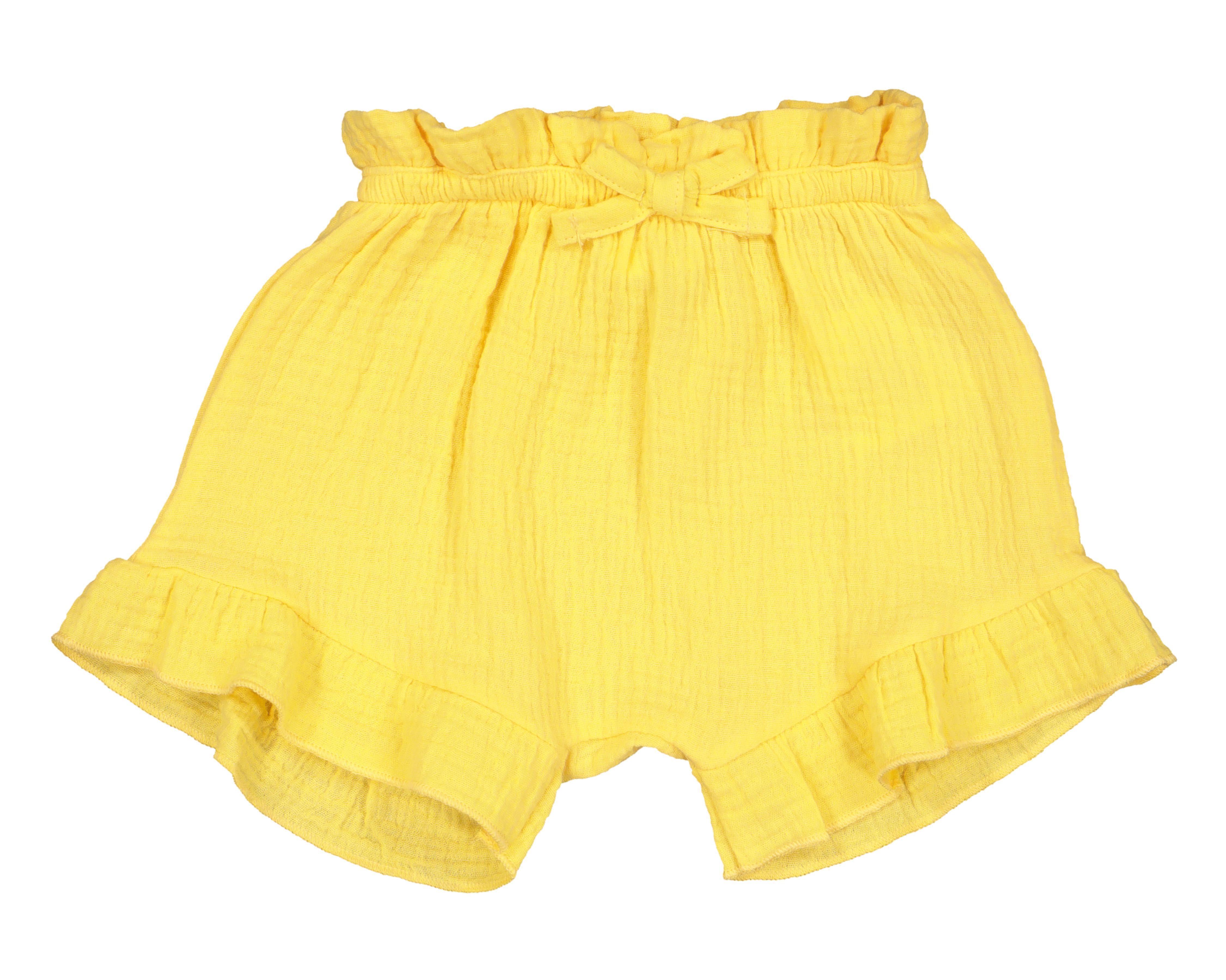 Foto 5 pulgar | Conjunto de Bebé Baby Colors con Lentes 3 Piezas